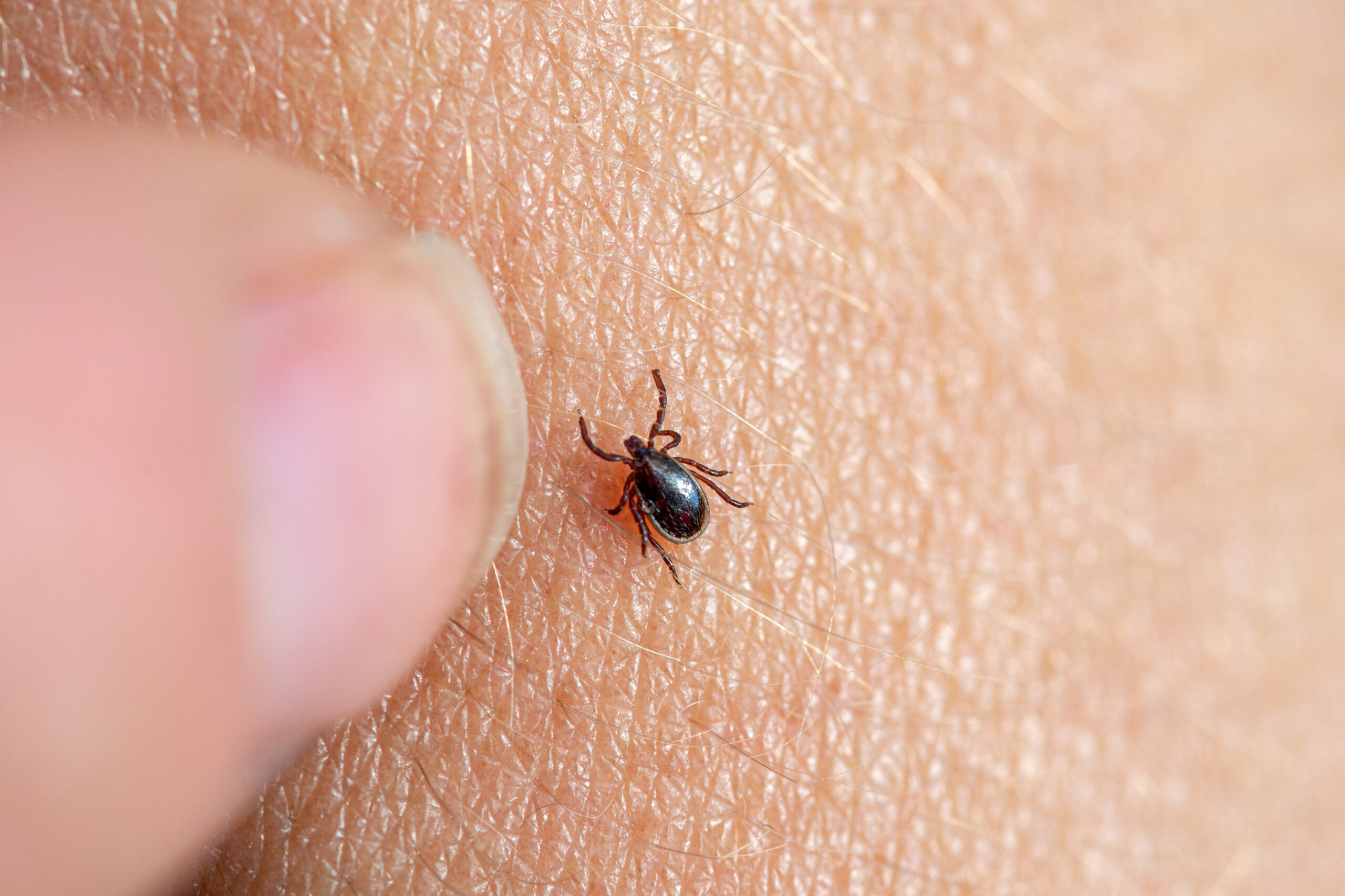 Reliable Pest Control in Glen Burnie, MD